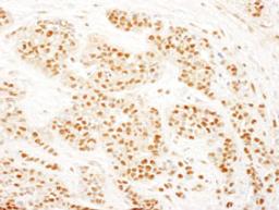 Detection of human RAD23B by immunohistochemistry.