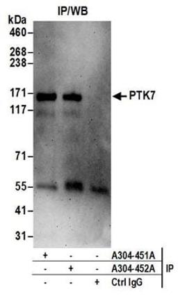 Detection of human PTK7 by western blot of immunoprecipitates.