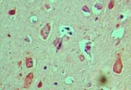 Immunohistochemistry-Paraffin: Cactin Antibody [NBP1-70775] - staining of human brain using Cactin polyclonal antibody at 5 ug/ml.