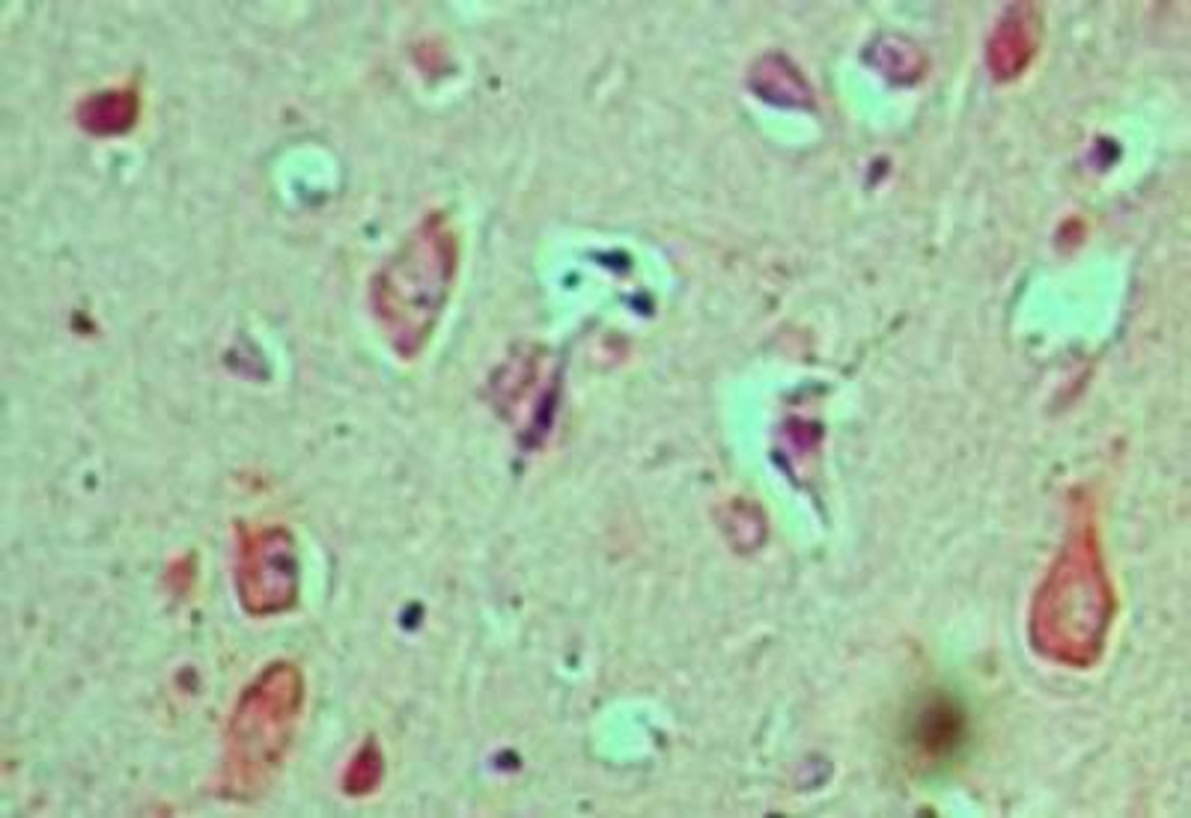 Immunohistochemistry-Paraffin: Cactin Antibody [NBP1-70775] - staining of human brain using Cactin polyclonal antibody at 5 ug/ml.