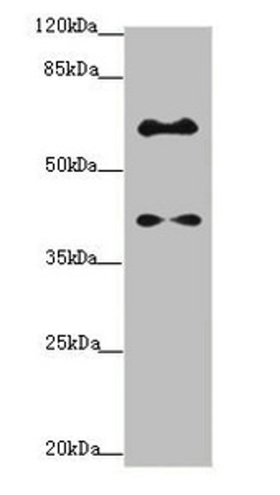 Western blot. All lanes: SYCE1 antibody at 1.14ug/ml + Mouse liver tissue. Secondary. Goat polyclonal to rabbit IgG at 1/10000 dilution. Predicted band size: 40, 33, 22 kDa. Observed band size: 40, 58 kDa.