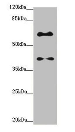 Western blot. All lanes: SYCE1 antibody at 1.14ug/ml + Mouse liver tissue. Secondary. Goat polyclonal to rabbit IgG at 1/10000 dilution. Predicted band size: 40, 33, 22 kDa. Observed band size: 40, 58 kDa.