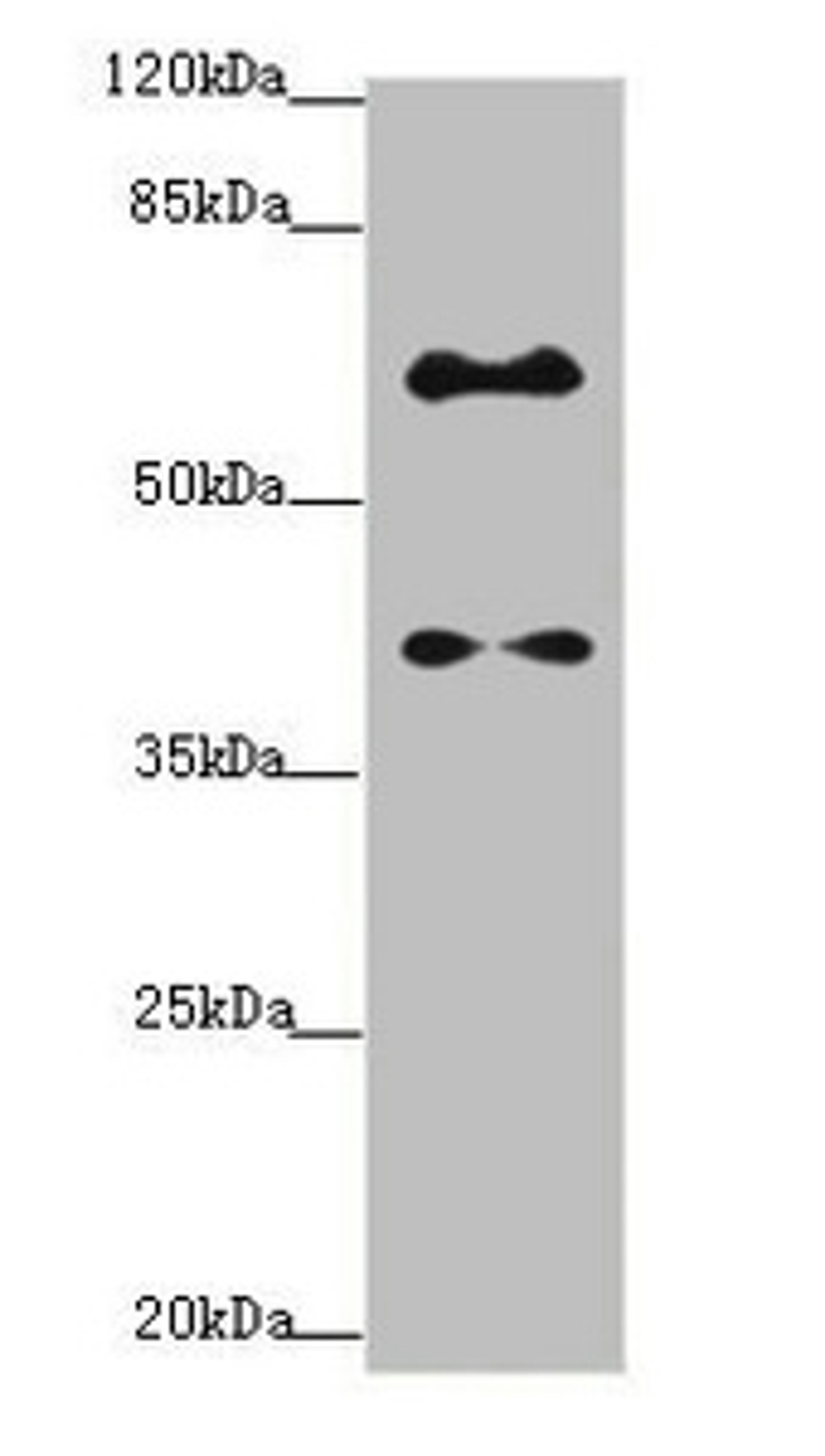 Western blot. All lanes: SYCE1 antibody at 1.14ug/ml + Mouse liver tissue. Secondary. Goat polyclonal to rabbit IgG at 1/10000 dilution. Predicted band size: 40, 33, 22 kDa. Observed band size: 40, 58 kDa.