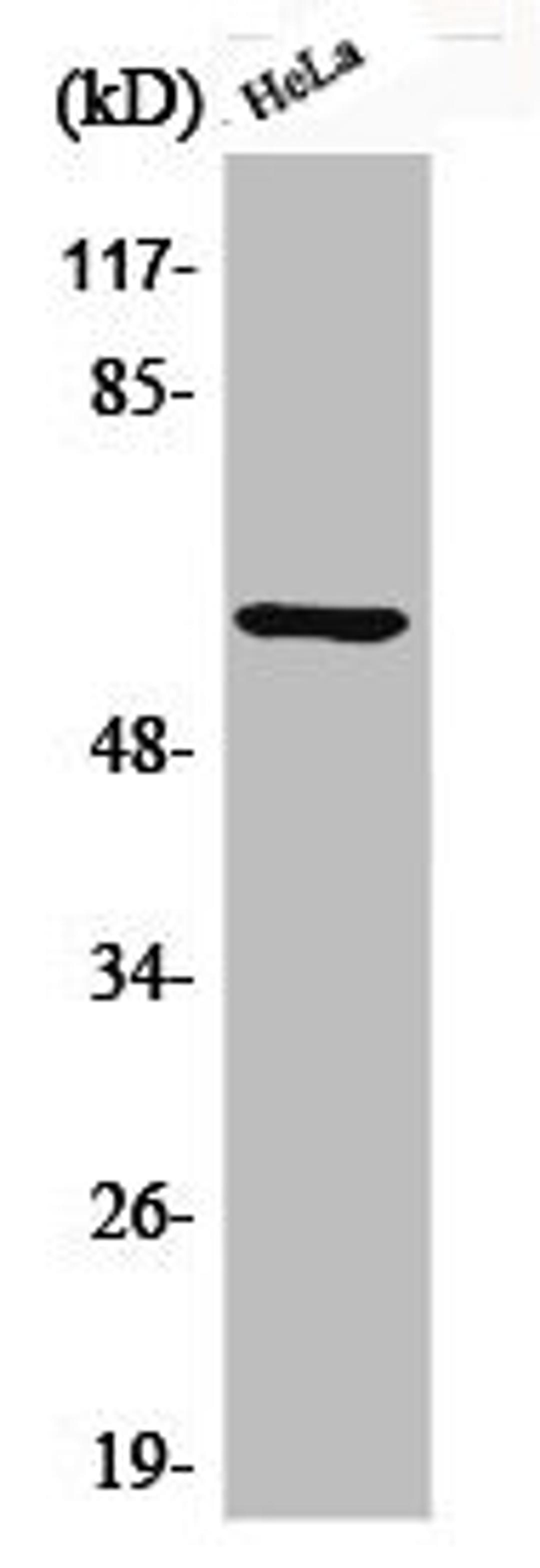 Western Blot analysis of HeLa cells using Phospho-Akt1 (S246) Polyclonal Antibody