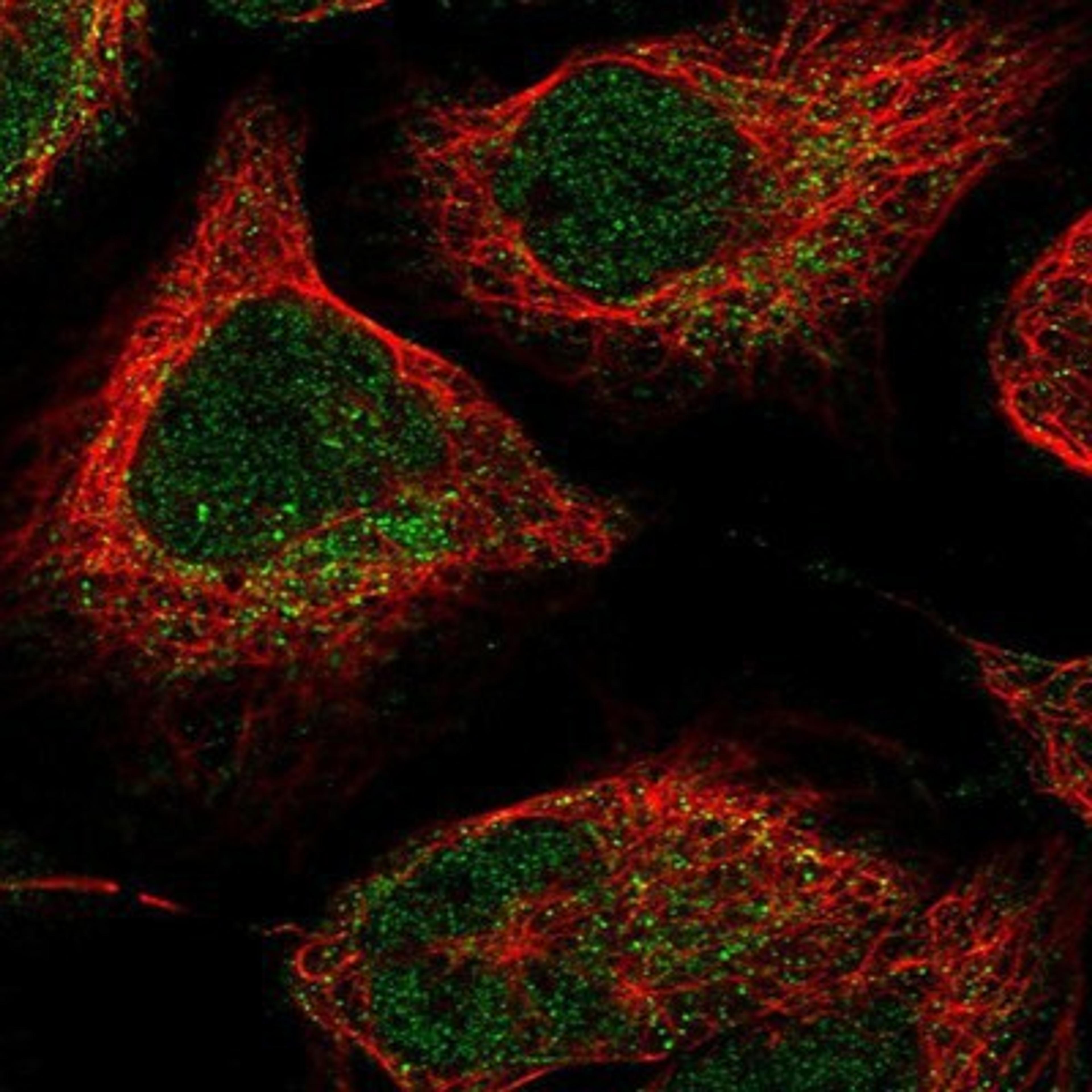 Immunocytochemistry/Immunofluorescence: TYKi Antibody [NBP1-80653] Staining of human cell line U-2 OS shows positivity in nucleus but not nucleoli & mitochondria.