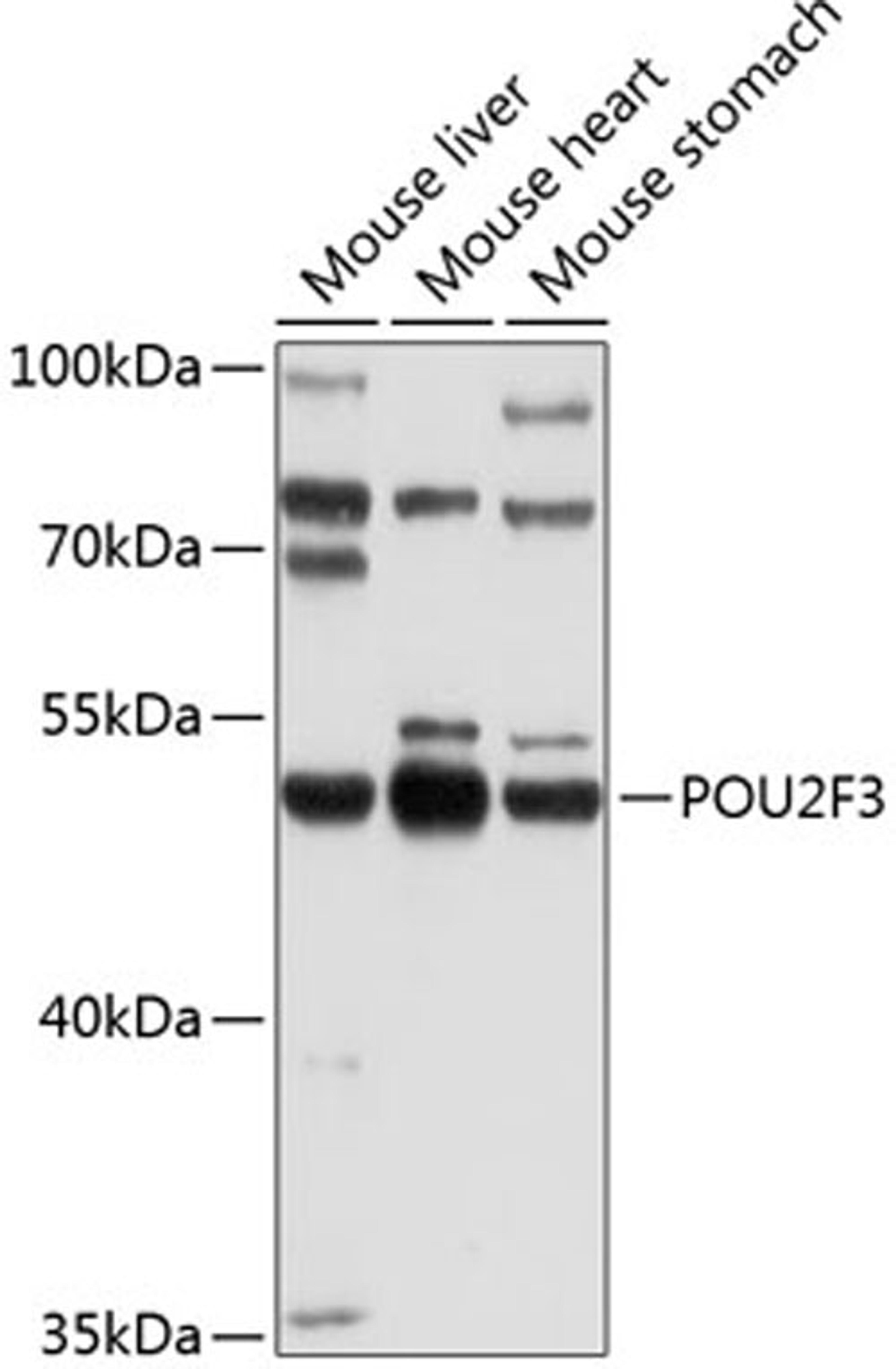 Western blot - POU2F3 Antibody (A10054)