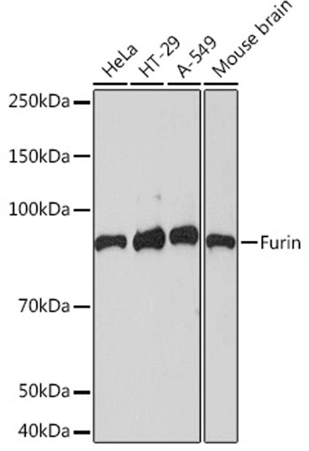 Western blot - Furin Rabbit mAb (A5043)