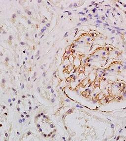 Immunohistochemical analysis of formalin fixed and paraffin embedded human kidney tissue using ESM1 antibody