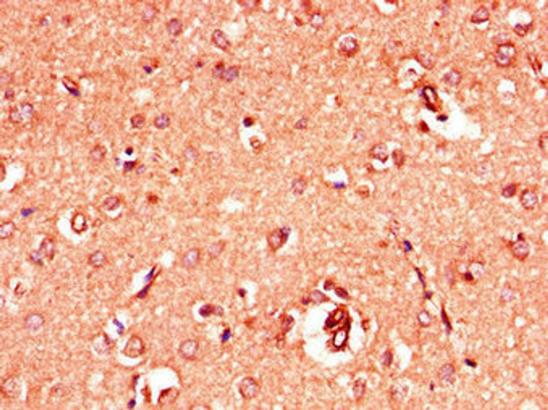 Immunohistochemistry of paraffin-embedded human brain tissue using CSB-PA009901LA01HU at dilution of 1:100
