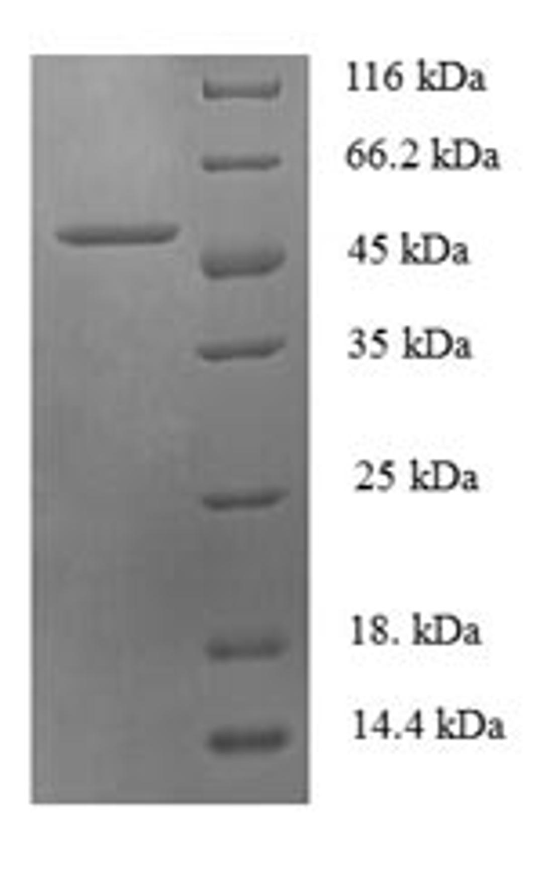 (Tris-Glycine gel) Discontinuous SDS-PAGE (reduced) with 5% enrichment gel and 15% separation gel.