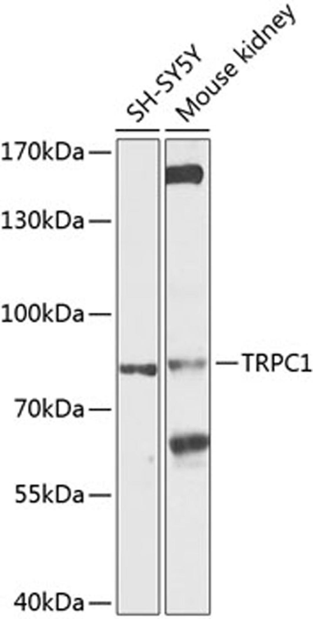 Western blot - TRPC1 antibody (A9952)