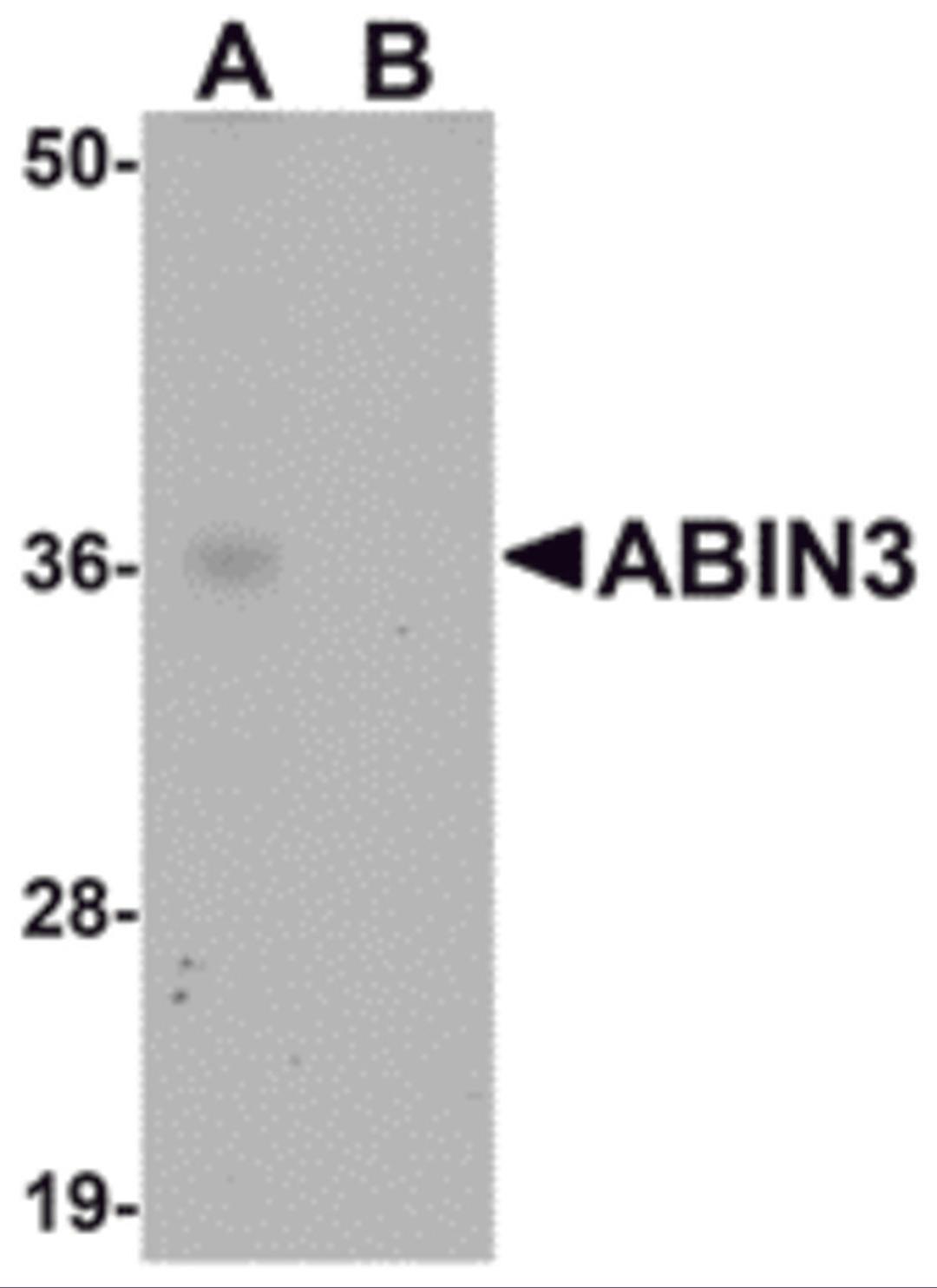 Western blot analysis of ABIN3 in human spleen tissue lysate with ABIN3 antibody at 1 &#956;g/mL in (A) the absence and (B) the presence of blocking peptide.