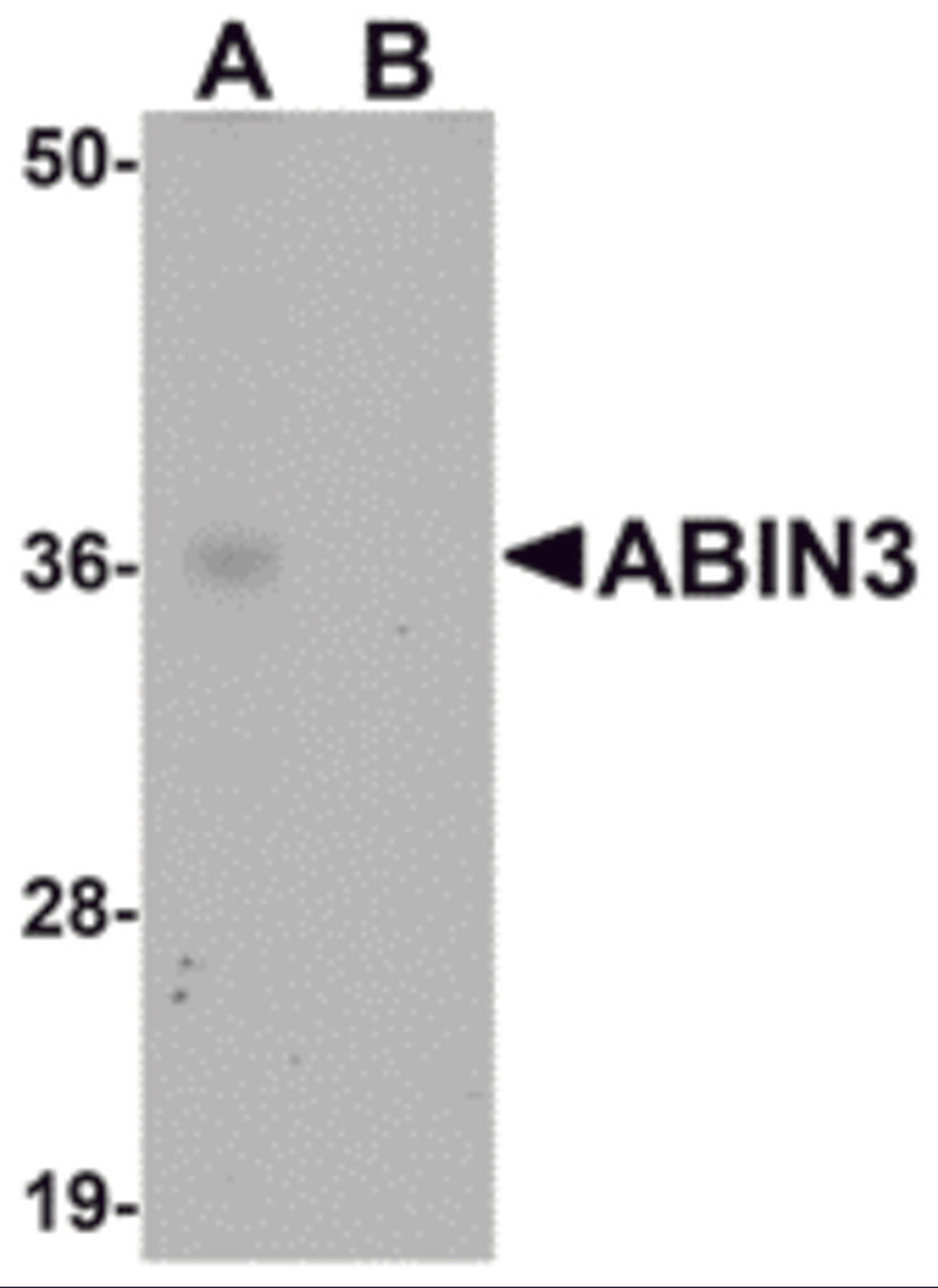 Western blot analysis of ABIN3 in human spleen tissue lysate with ABIN3 antibody at 1 &#956;g/mL in (A) the absence and (B) the presence of blocking peptide.