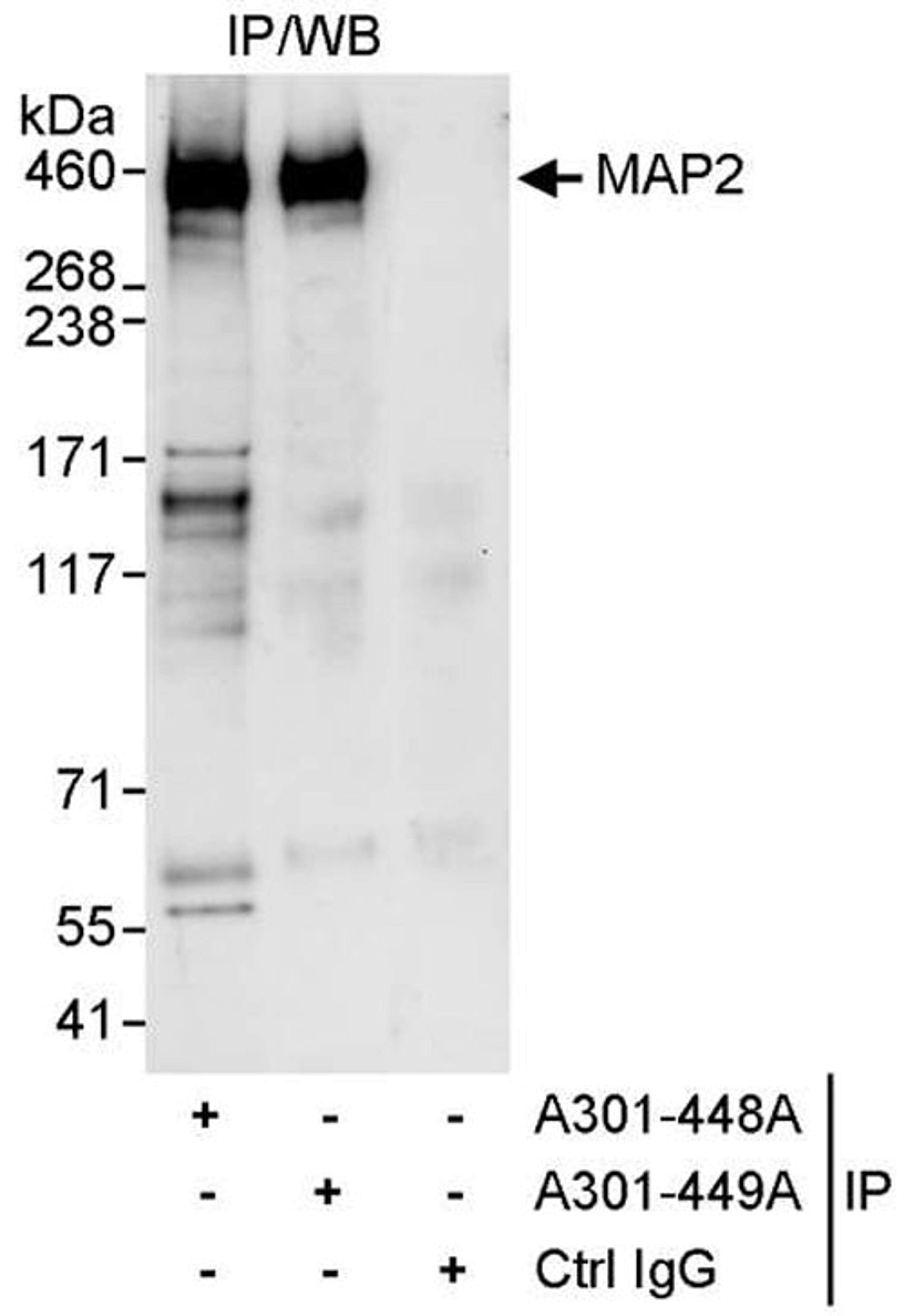 Detection of human MAP2 by WB of IP.