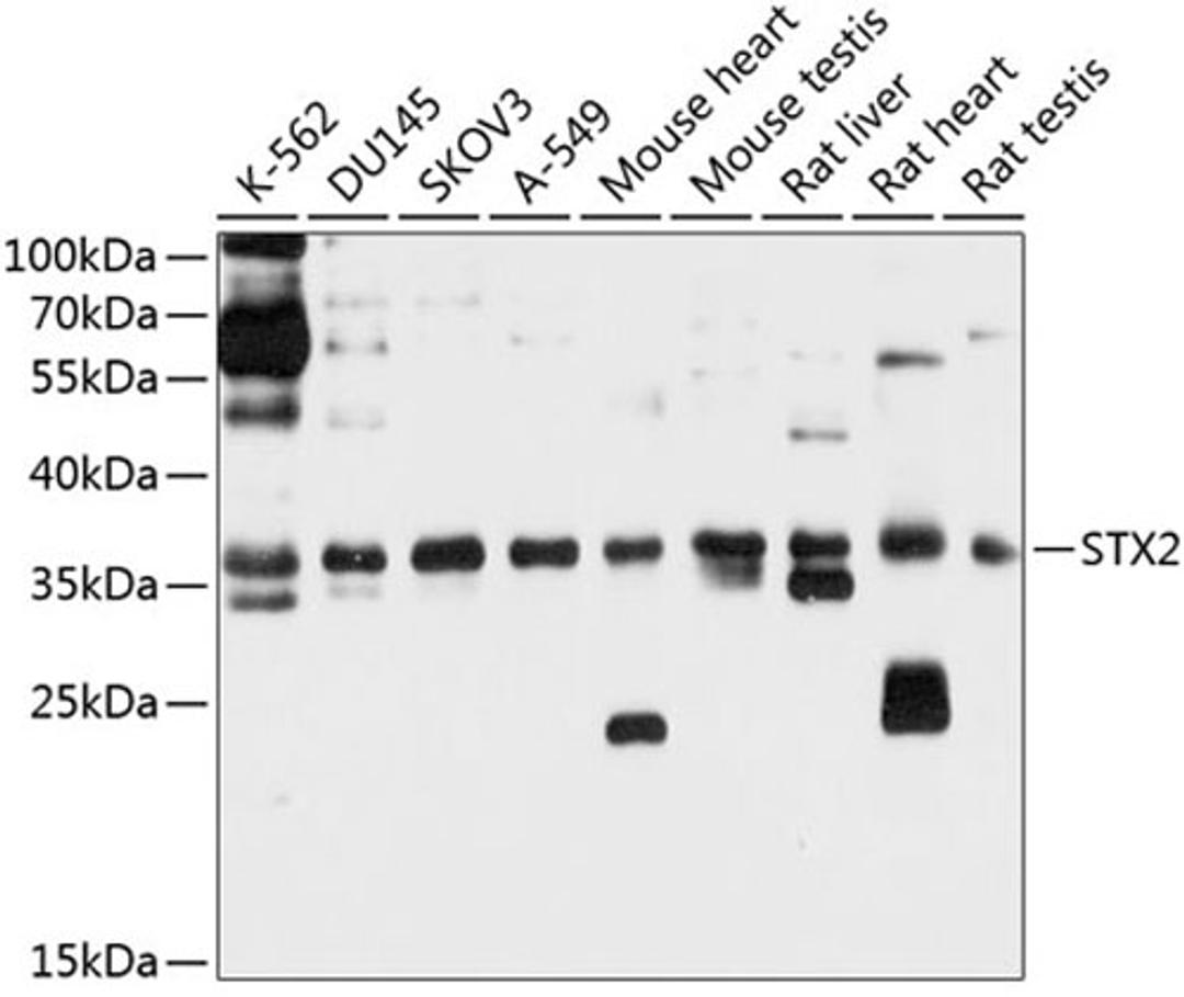 Western blot - STX2 antibody (A10444)