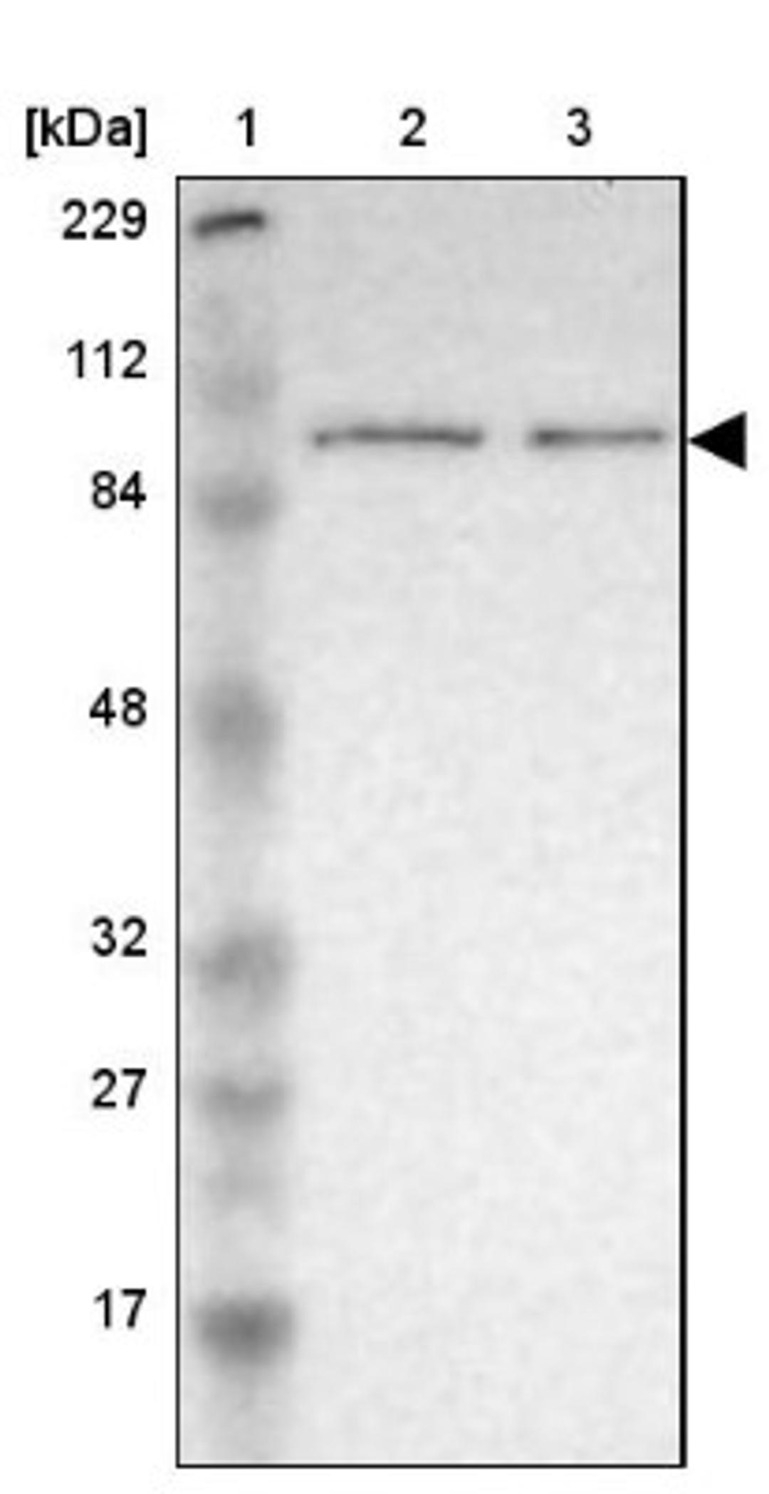 Western Blot: PDE5A Antibody [NBP1-86139] - Lane 1: Marker [kDa] 229, 112, 84, 48, 32, 27, 17<br/>Lane 2: Human cell line RT-4<br/>Lane 3: Human cell line U-251MG sp