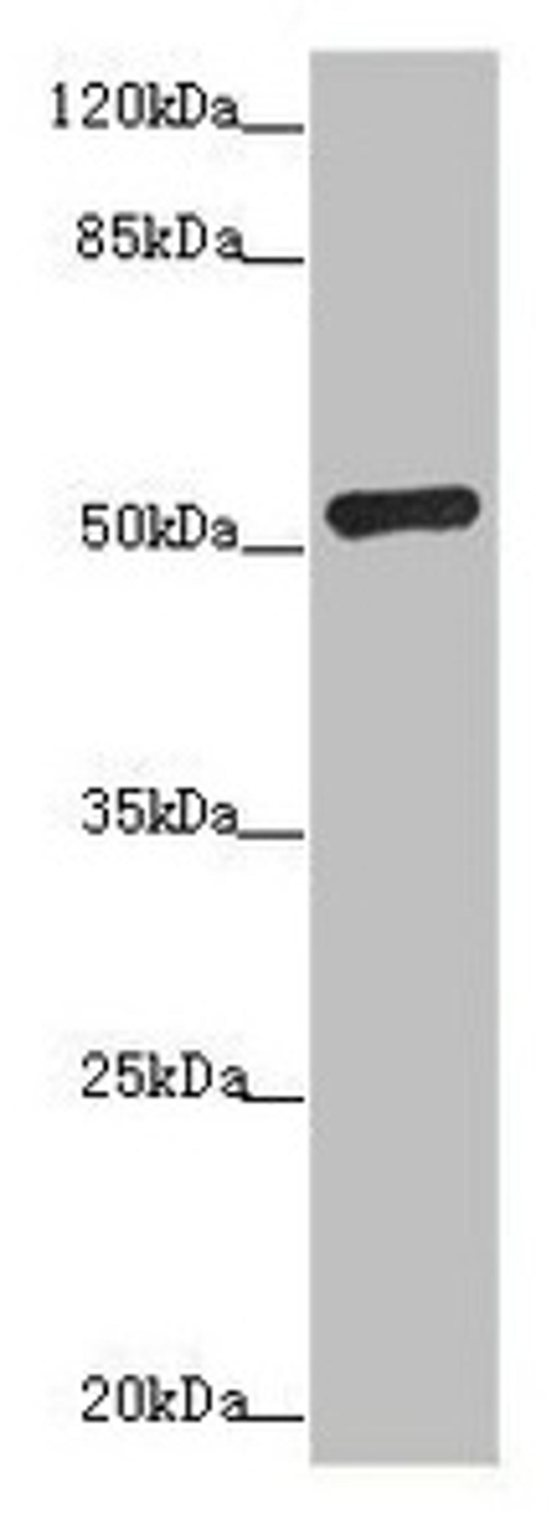Western blot. All lanes: ADPGK antibody at 1.02µg/ml + Hela whole cell lysate. Secondary. Goat polyclonal to rabbit IgG at 1/10000 dilution. Predicted band size: 55, 54, 29, 25, 39, 9 kDa. Observed band size: 54 kDa