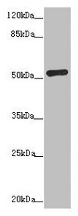 Western blot. All lanes: ADPGK antibody at 1.02µg/ml + Hela whole cell lysate. Secondary. Goat polyclonal to rabbit IgG at 1/10000 dilution. Predicted band size: 55, 54, 29, 25, 39, 9 kDa. Observed band size: 54 kDa