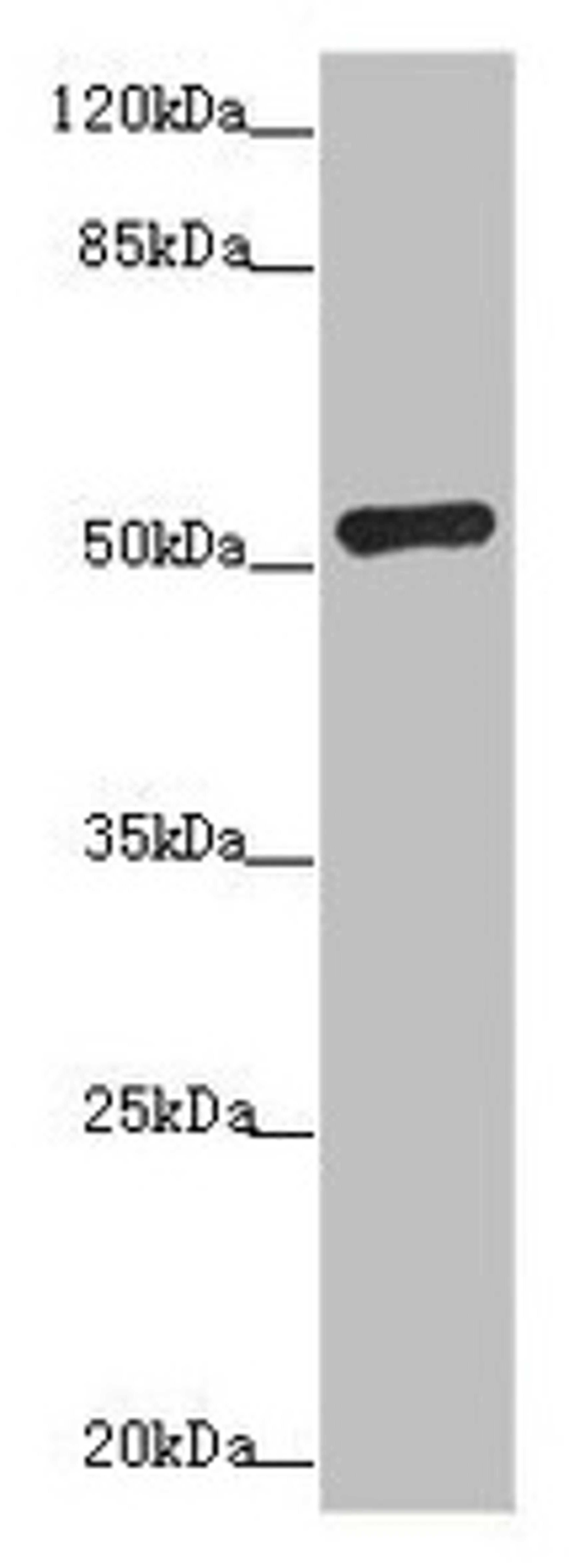 Western blot. All lanes: ADPGK antibody at 1.02µg/ml + Hela whole cell lysate. Secondary. Goat polyclonal to rabbit IgG at 1/10000 dilution. Predicted band size: 55, 54, 29, 25, 39, 9 kDa. Observed band size: 54 kDa