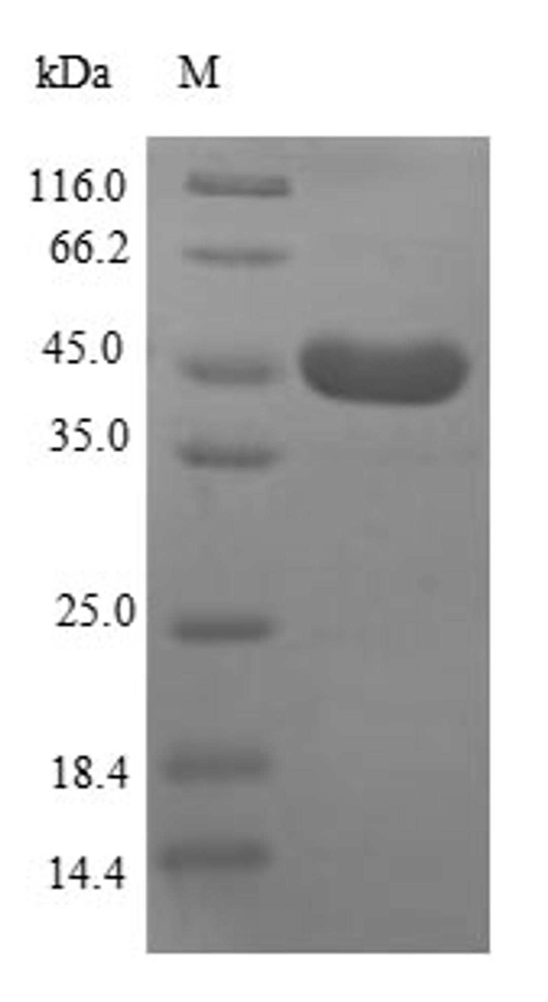 (Tris-Glycine gel) Discontinuous SDS-PAGE (reduced) with 5% enrichment gel and 15% separation gel.