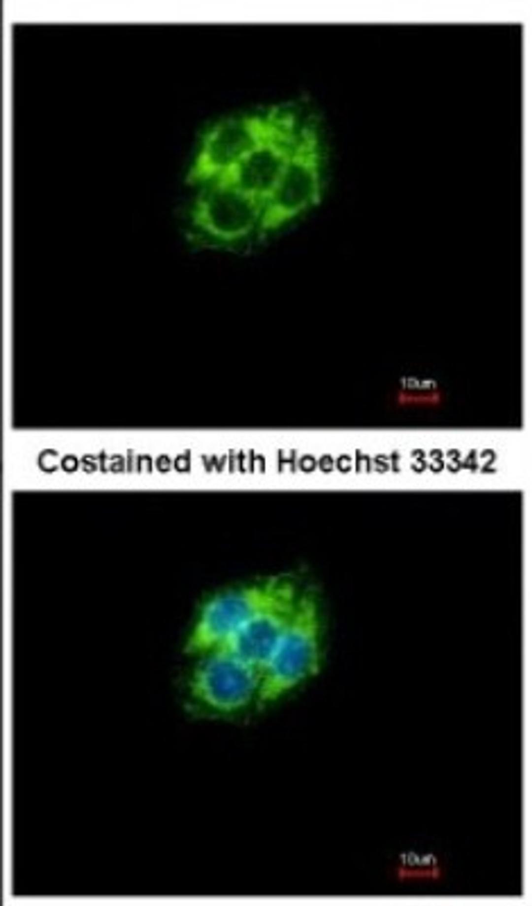 Immunocytochemistry/Immunofluorescence: ABAT Antibody [NBP2-21598] - Immunofluorescence analysis of methanol-fixed Hep G2, using antibody at 1:500 dilution.