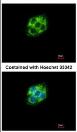 Immunocytochemistry/Immunofluorescence: ABAT Antibody [NBP2-21598] - Immunofluorescence analysis of methanol-fixed Hep G2, using antibody at 1:500 dilution.