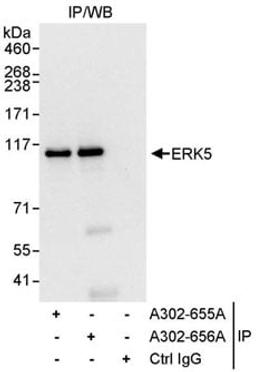 Detection of human ERK5 by western blot of immunoprecipitates.