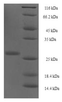 (Tris-Glycine gel) Discontinuous SDS-PAGE (reduced) with 5% enrichment gel and 15% separation gel.