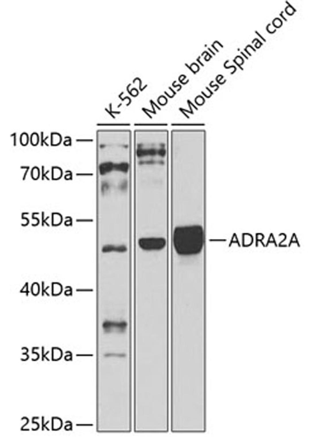 Western blot - ADRA2A antibody (A2809)