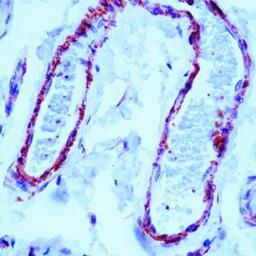 Immunohistochemistry-Paraffin: Filamin Antibody (FLMN01 (PM6/317)) [NB600-1218] - Staining of human skin stained with Filamin antibody using peroxidase-conjugate and AEC chromogen. Note cytoplasmic staining of smooth muscle cells surrounding blood vessels.