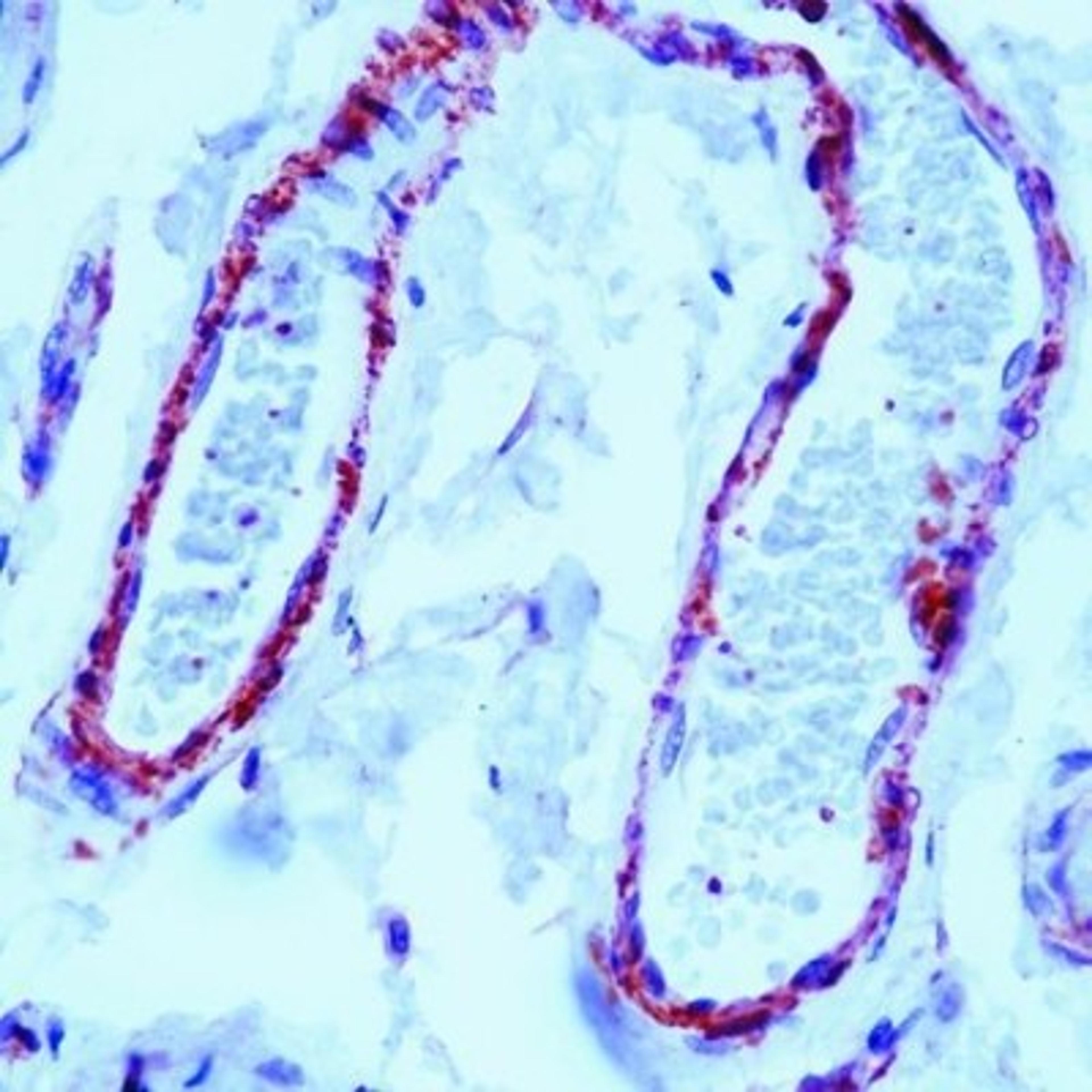 Immunohistochemistry-Paraffin: Filamin Antibody (FLMN01 (PM6/317)) [NB600-1218] - Staining of human skin stained with Filamin antibody using peroxidase-conjugate and AEC chromogen. Note cytoplasmic staining of smooth muscle cells surrounding blood vessels.