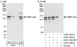 Detection of human C/EBP zeta by western blot and immunoprecipitation.