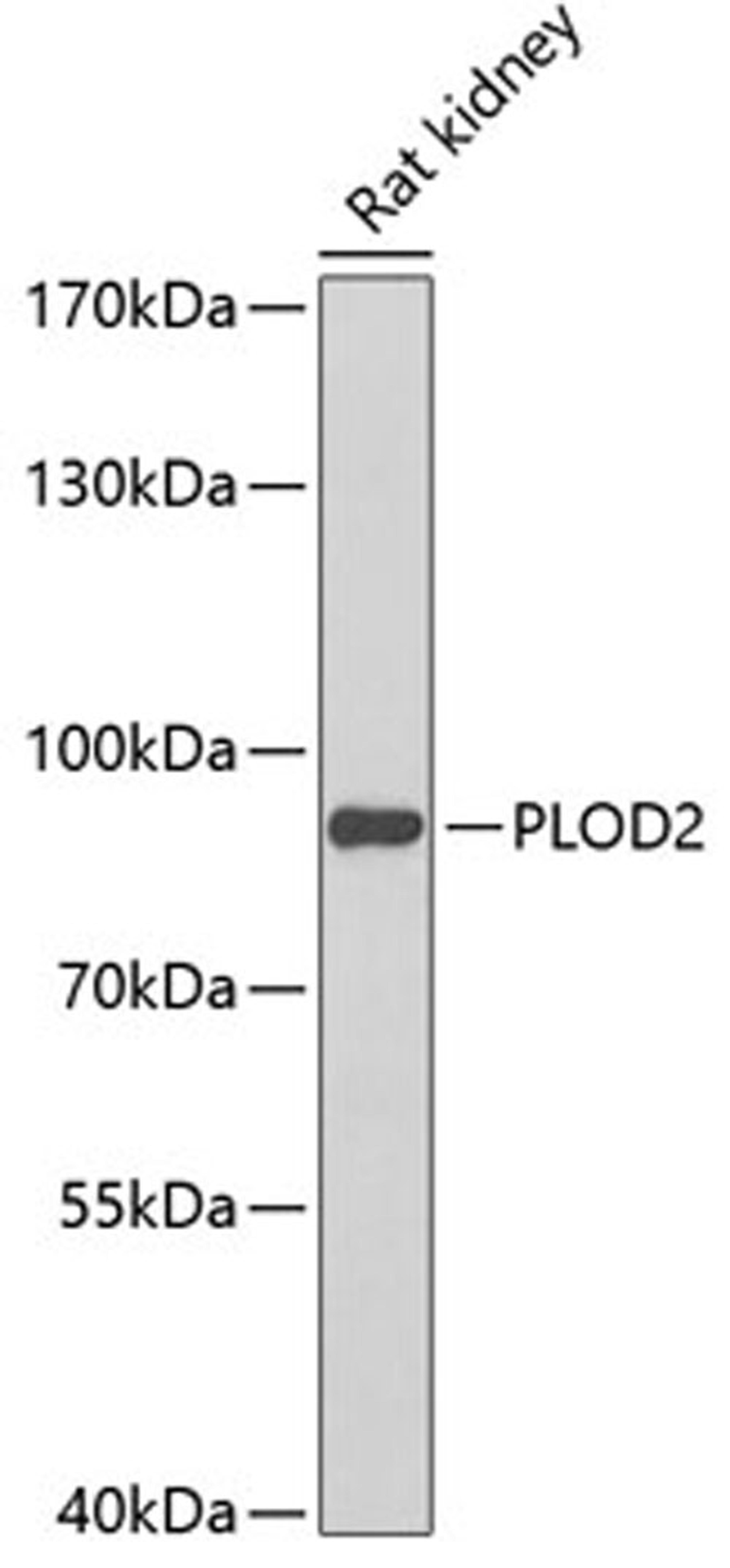 Western blot - PLOD2 Antibody (A6946)