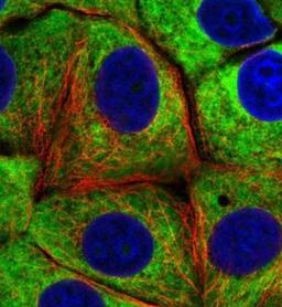 Immunocytochemistry/Immunofluorescence: RPS23 Antibody [NBP2-30412] - Staining of human cell line MCF7 shows positivity in nucleoli & cytoplasm. Antibody staining is shown in green.