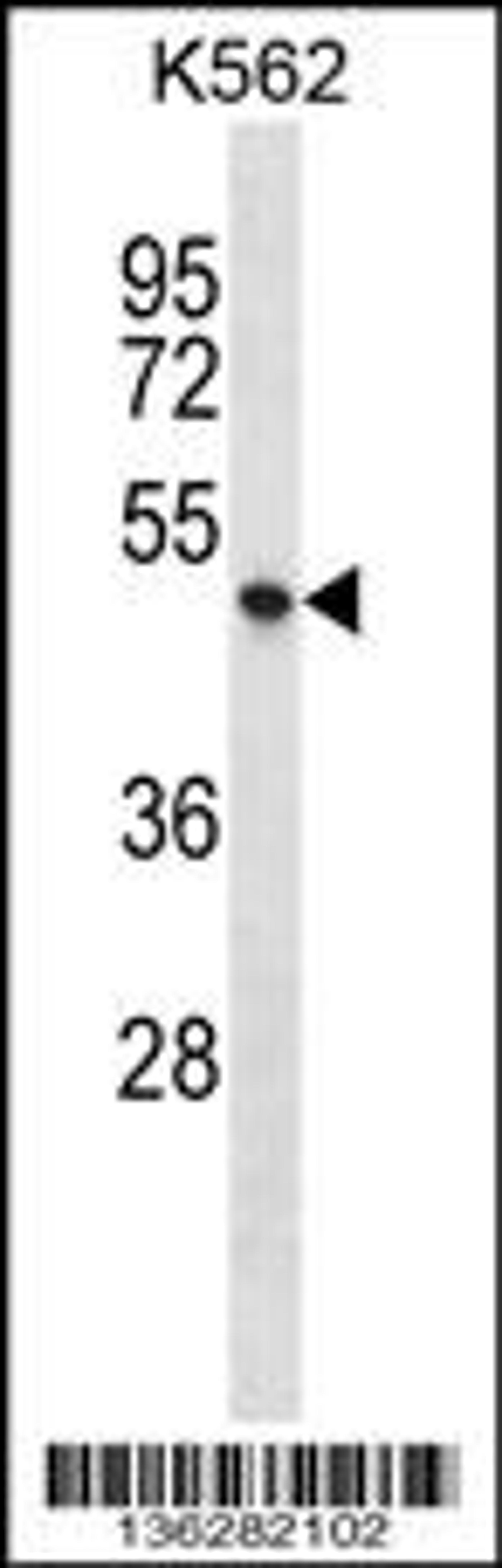 Western blot analysis in K562 cell line lysates (35ug/lane).