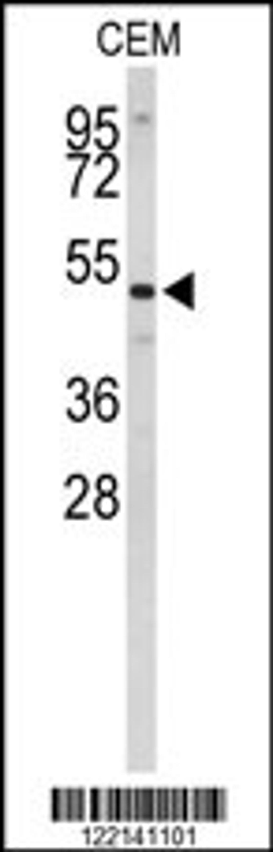 Western blot analysis of CNDP1 Antibody in CEM cell line lysates (35ug/lane)