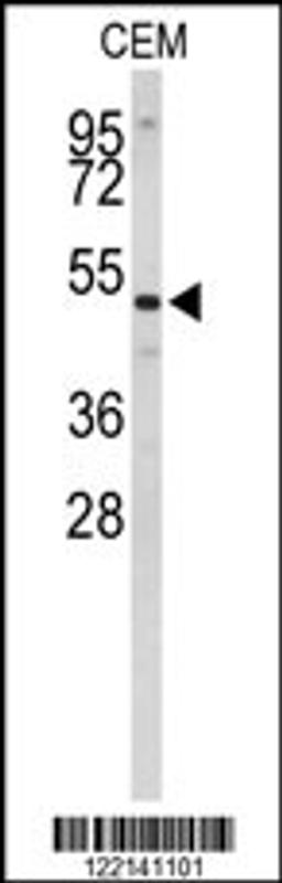 Western blot analysis of CNDP1 Antibody in CEM cell line lysates (35ug/lane)