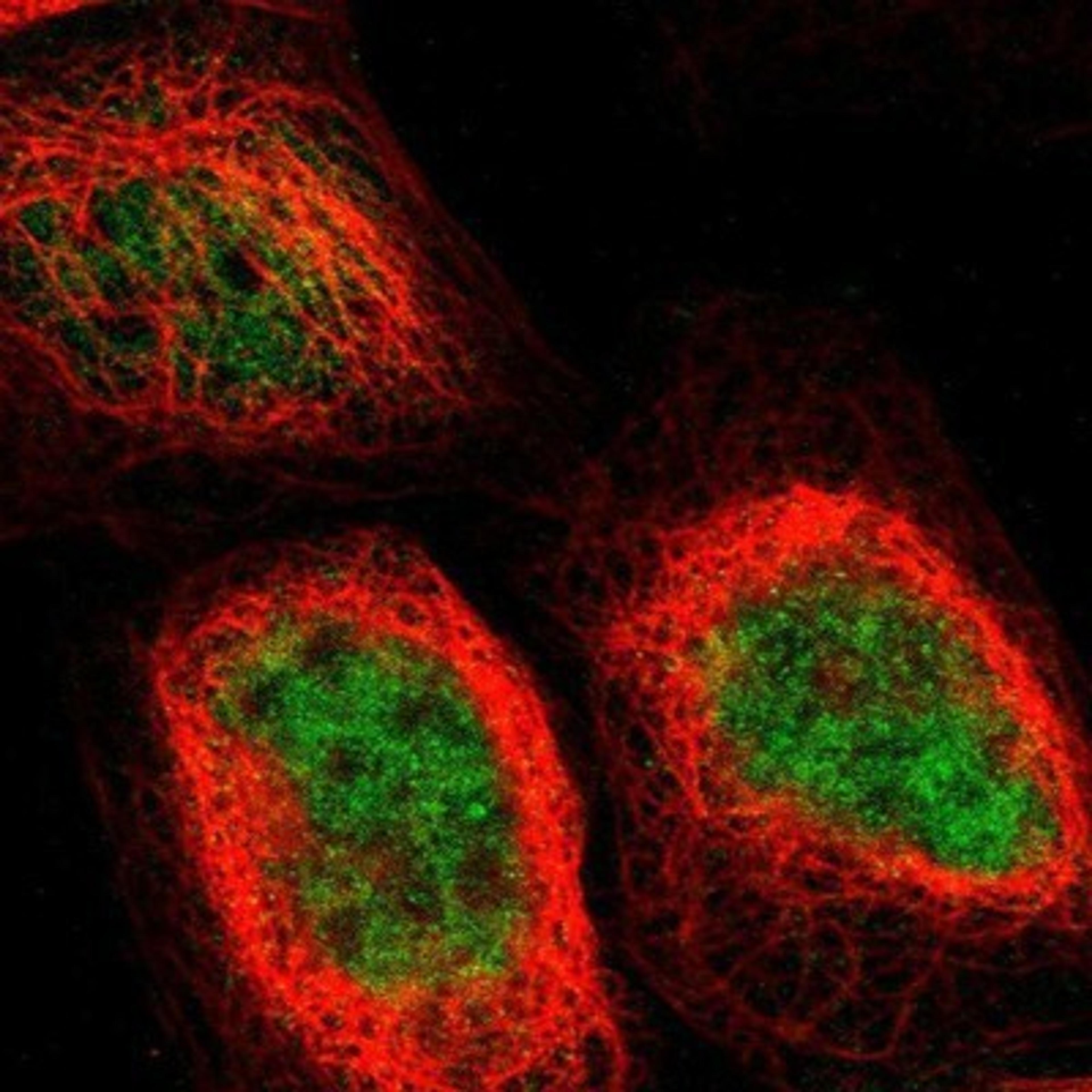 Immunocytochemistry/Immunofluorescence: GMEB2 Antibody [NBP1-81421] - Staining of human cell line A-431 shows positivity in nucleus but not nucleoli & cytoplasm.