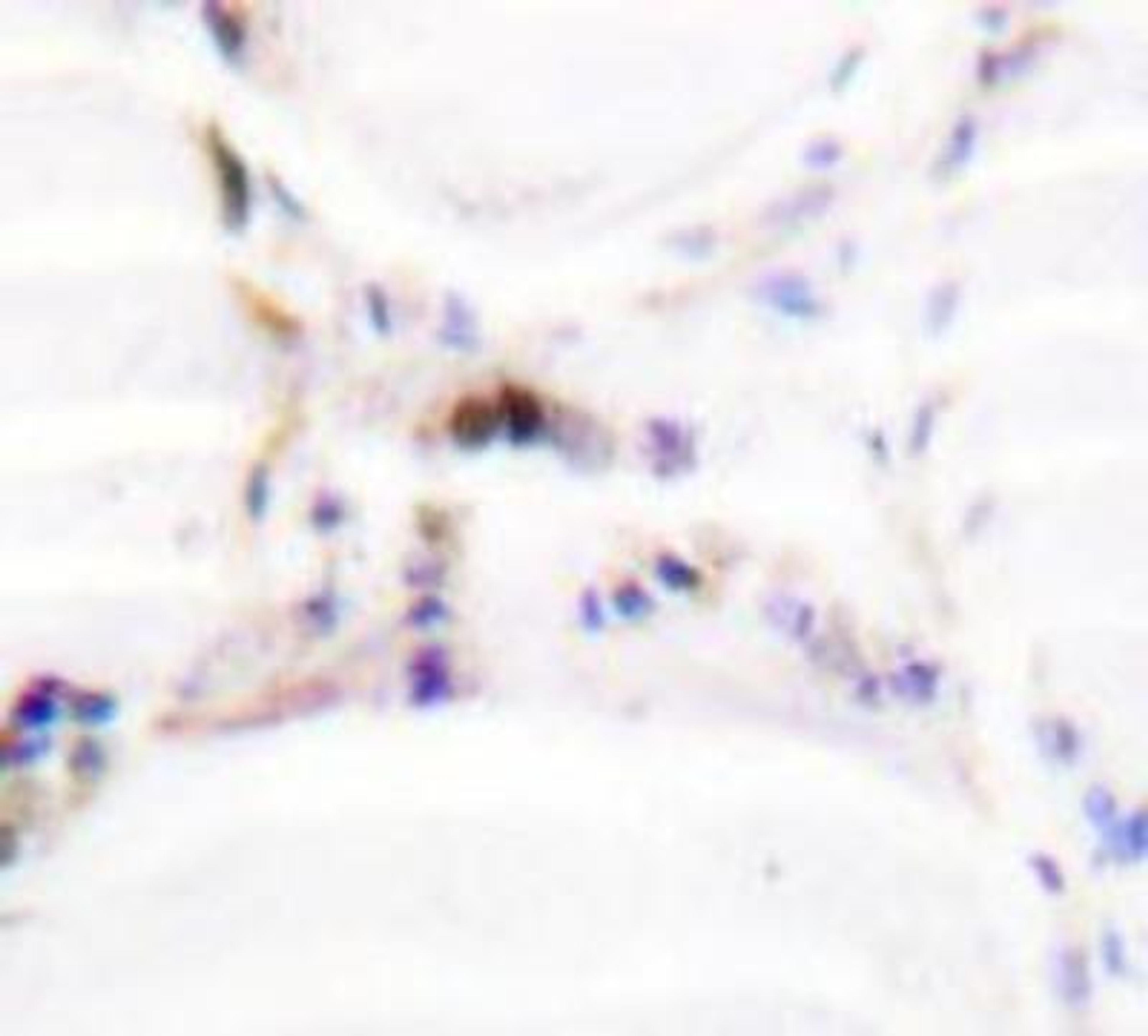 Immunohistochemistry: VDR/NR1I1/Vitamin D Receptor Antibody [NBP1-19478] - Human thyroid gland tissue.