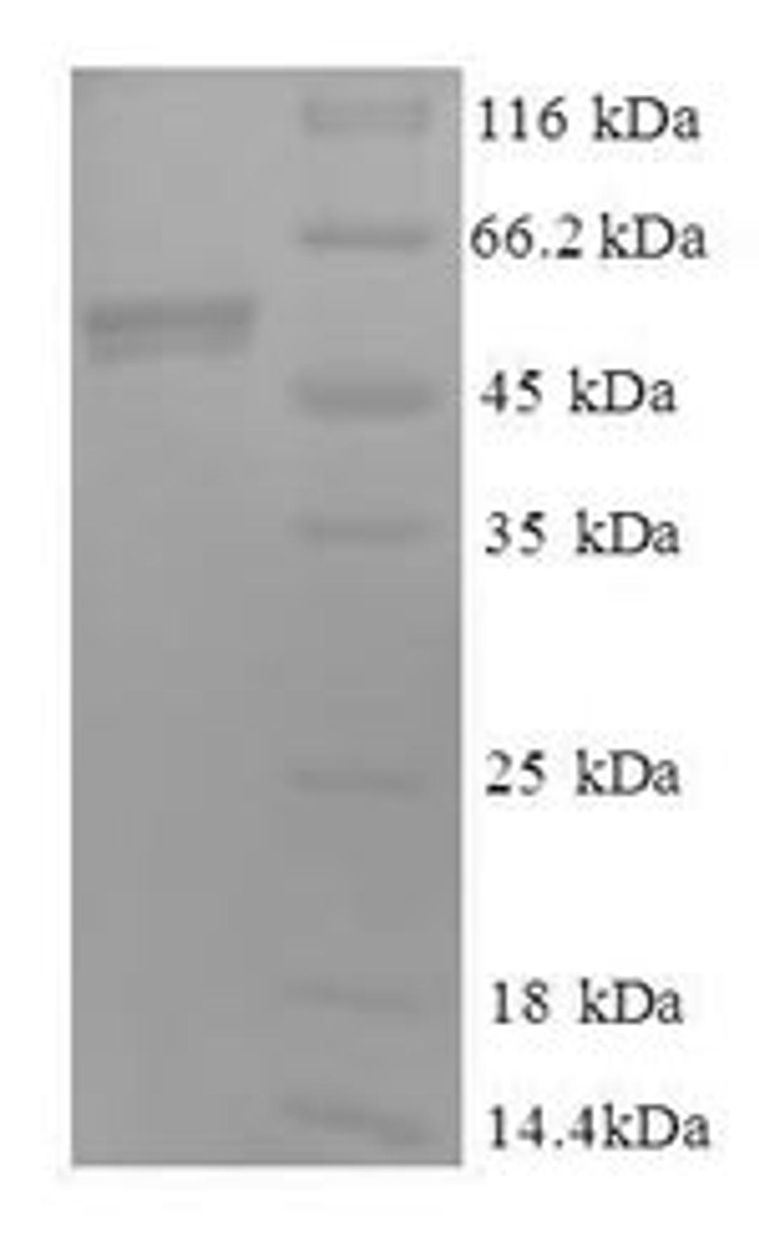 (Tris-Glycine gel) Discontinuous SDS-PAGE (reduced) with 5% enrichment gel and 15% separation gel.