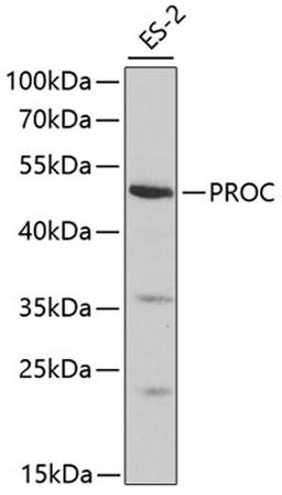 Western blot - PROC antibody (A1432)