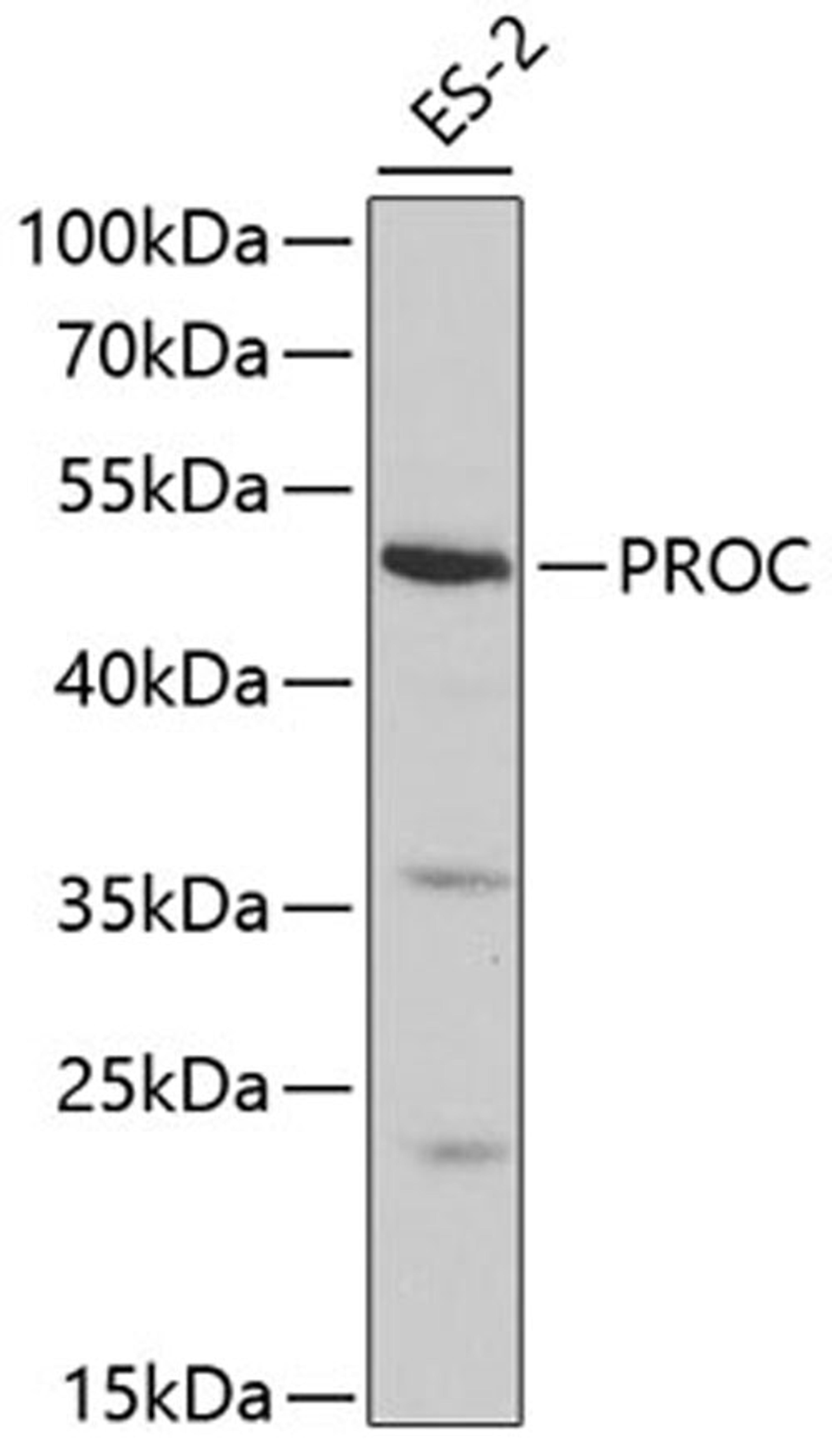 Western blot - PROC antibody (A1432)