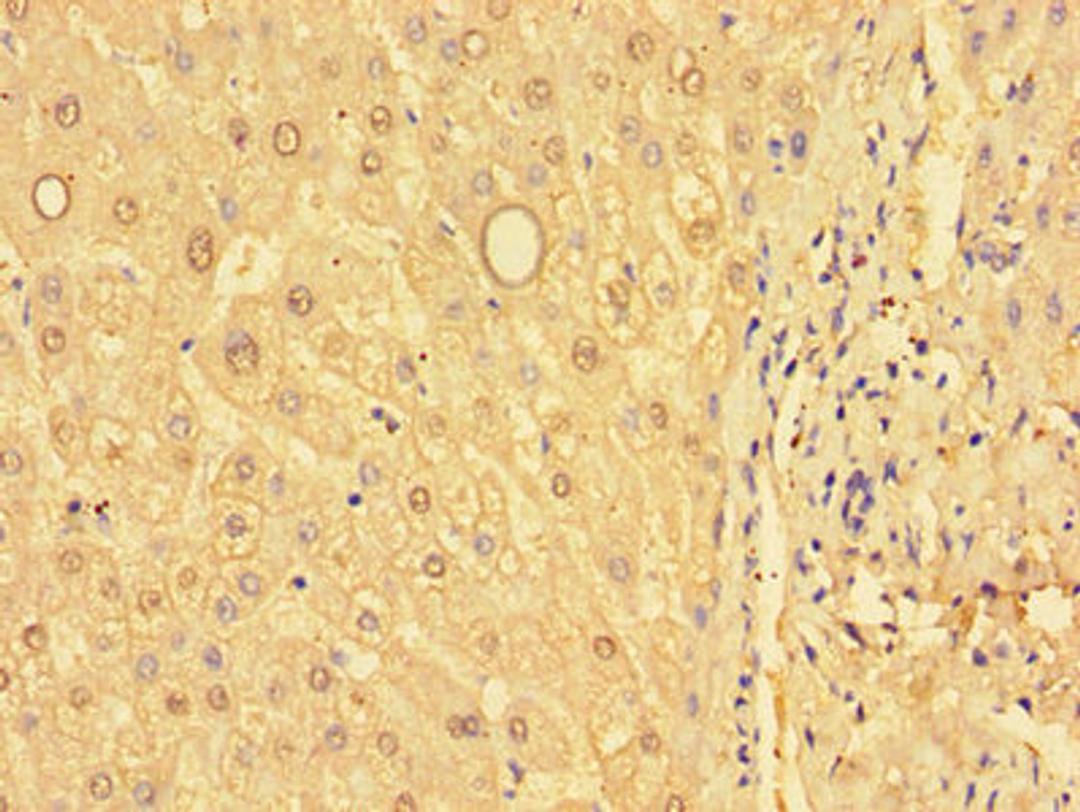 Immunohistochemistry of paraffin-embedded human liver tissue using CSB-PA009979LA01HU at dilution of 1:100