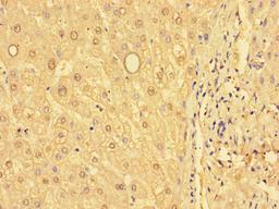 Immunohistochemistry of paraffin-embedded human liver tissue using CSB-PA009979LA01HU at dilution of 1:100