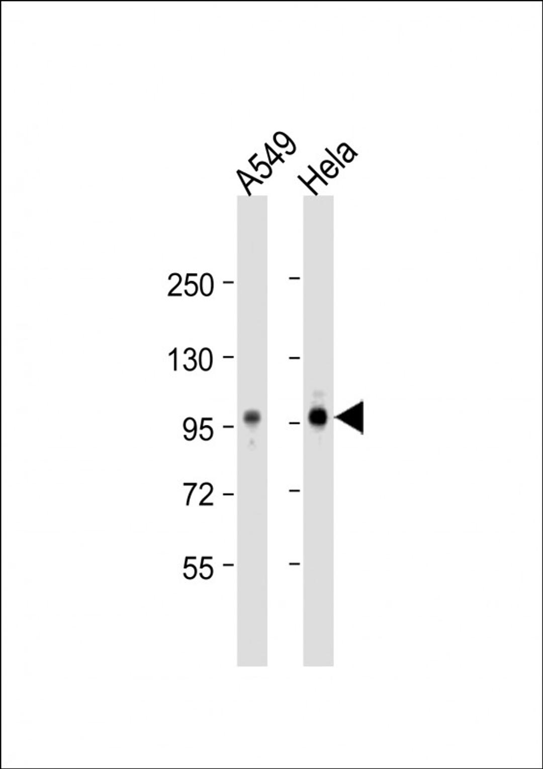 Western Blot at 1:1000 dilution Lane 1: A549 whole cell lysate Lane 2: Hela whole cell lysate Lysates/proteins at 20 ug per lane.