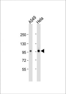 Western Blot at 1:1000 dilution Lane 1: A549 whole cell lysate Lane 2: Hela whole cell lysate Lysates/proteins at 20 ug per lane.