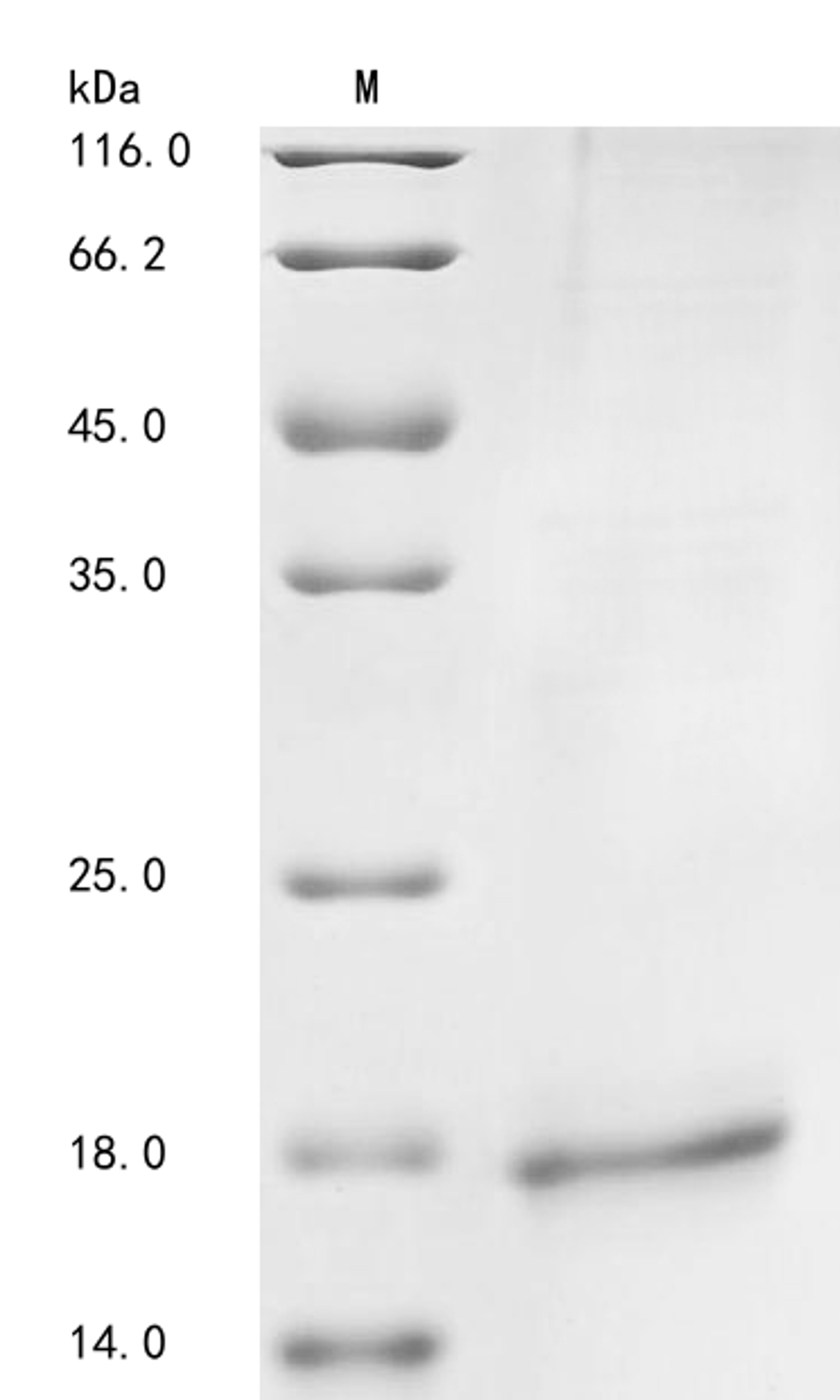 (Tris-Glycine gel) Discontinuous SDS-PAGE (reduced) with 5% enrichment gel and 15% separation gel.