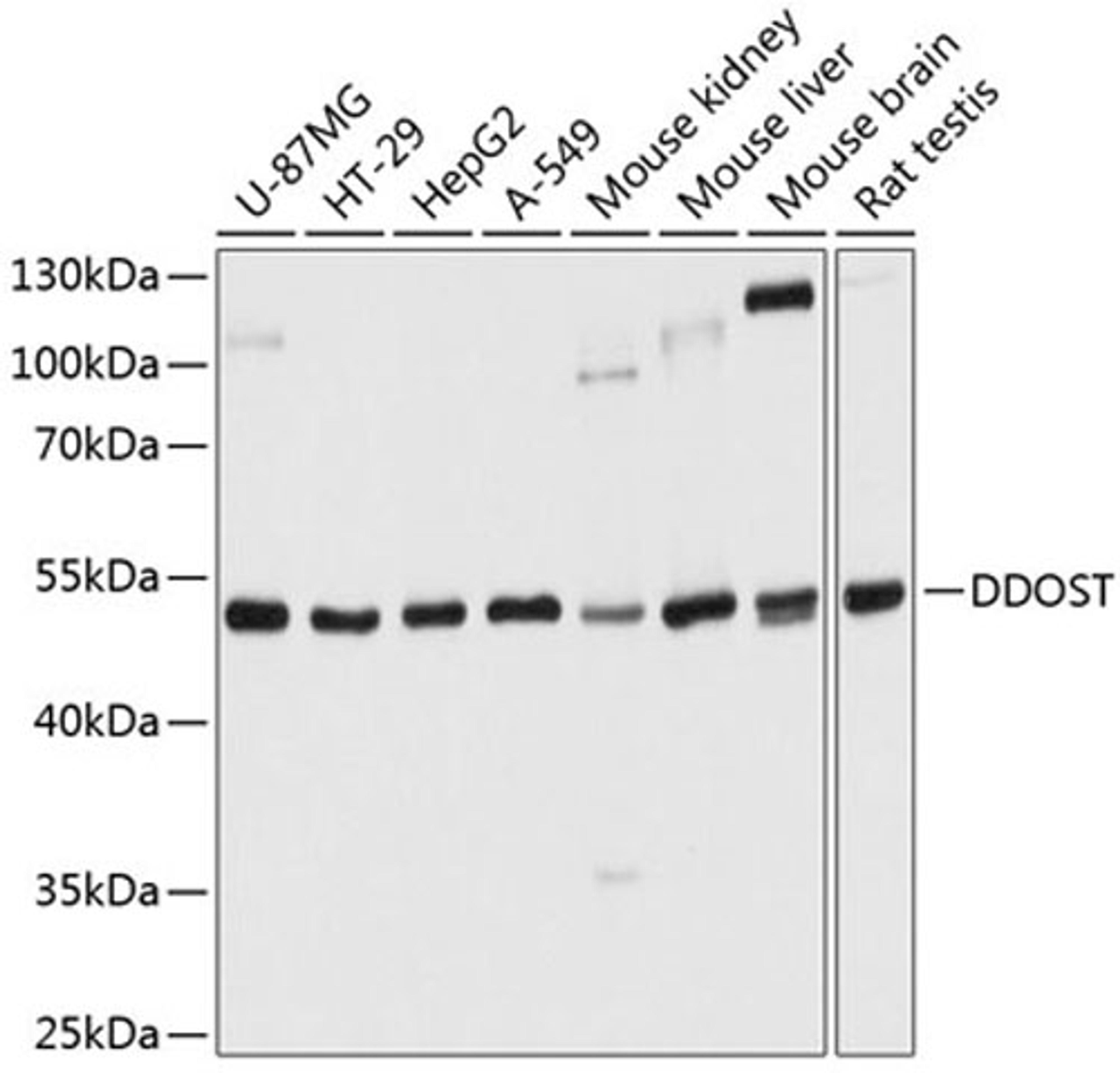 Western blot - DDOST antibody (A9056)