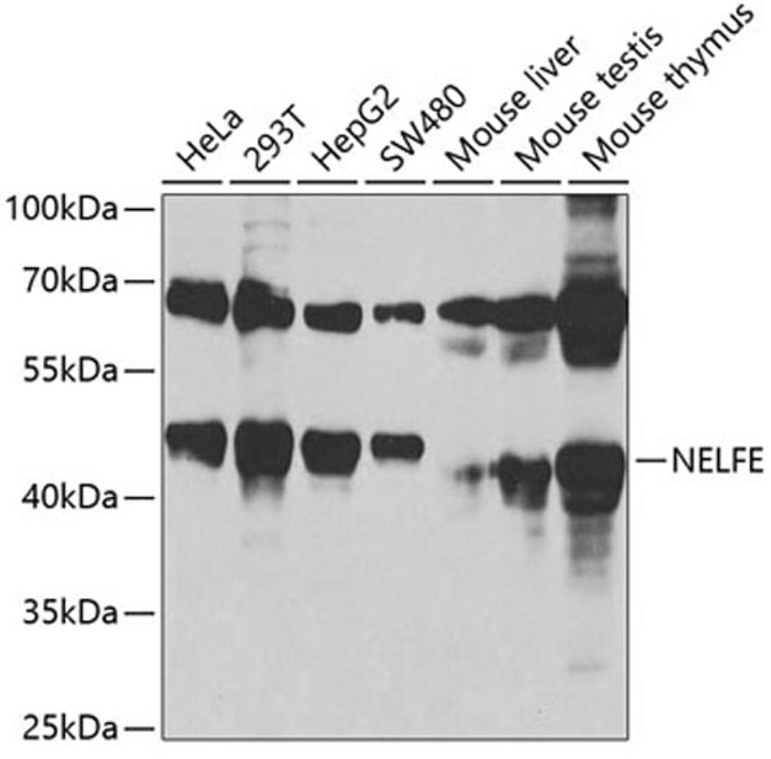 Western blot - NELFE antibody (A3249)