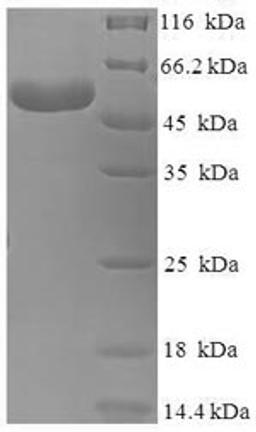 (Tris-Glycine gel) Discontinuous SDS-PAGE (reduced) with 5% enrichment gel and 15% separation gel.